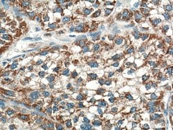 OTC Rabbit anti-Human, Mouse, Rat, Polyclonal, Proteintech 150 &mu;L; Unconjugated:Antibodies,