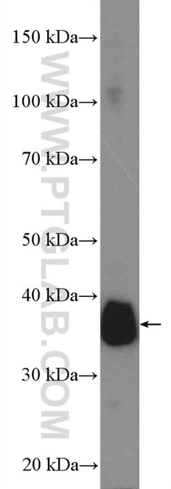 OTC Rabbit anti-Human, Mouse, Rat, Polyclonal, Proteintech 150 &mu;L; Unconjugated:Antibodies,
