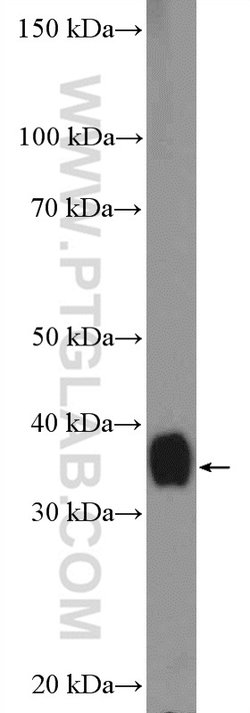 OTC Rabbit anti-Human, Mouse, Rat, Polyclonal, Proteintech 150 &mu;L; Unconjugated:Antibodies,