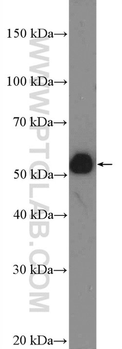 HOXA10 Rabbit anti-Human, Polyclonal, Proteintech 150 &mu;L; Unconjugated:Antibodies,