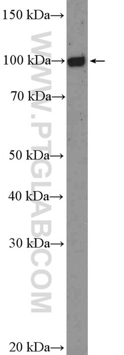 FCRL5 Rabbit anti-Human, Polyclonal, Proteintech:Antibodies:Primary Antibodies