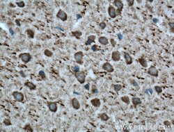 Parvalbumin Rabbit anti-Human, Mouse, Polyclonal, Proteintech 20 &mu;L | Buy Online | Proteintech | Fisher Scientific