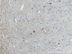 Parvalbumin Rabbit anti-Human, Mouse, Polyclonal, Proteintech 20 &mu;L | Buy Online | Proteintech | Fisher Scientific