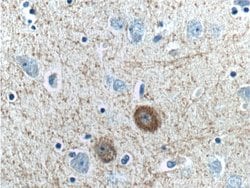 Parvalbumin Rabbit anti-Human, Mouse, Polyclonal, Proteintech 20 &mu;L | Buy Online | Proteintech | Fisher Scientific
