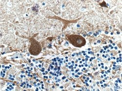 Parvalbumin Rabbit anti-Human, Mouse, Polyclonal, Proteintech 20 &mu;L | Buy Online | Proteintech | Fisher Scientific