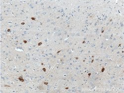 Parvalbumin Rabbit anti-Human, Mouse, Polyclonal, Proteintech 20 &mu;L | Buy Online | Proteintech | Fisher Scientific