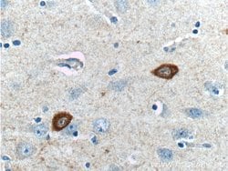 Parvalbumin Rabbit anti-Human, Mouse, Polyclonal, Proteintech 20 &mu;L | Buy Online | Proteintech | Fisher Scientific