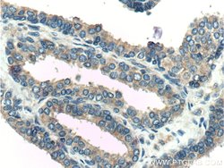 KLK4 Rabbit anti-Human, Polyclonal, Proteintech 150 &mu;L; Unconjugated:Antibodies,