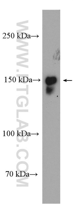 53BP2 Rabbit anti-Human, Polyclonal, Proteintech 150 &mu;L; Unconjugated:Antibodies,