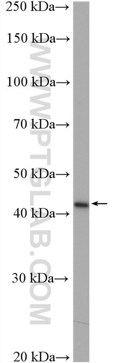SERPINB3 Rabbit anti-Human, Polyclonal, Proteintech 150 &mu;L; Unconjugated:Antibodies,