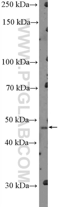 SERPINB3 Rabbit anti-Human, Polyclonal, Proteintech 150 &mu;L; Unconjugated:Antibodies,