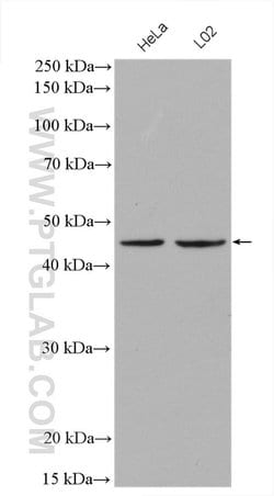 SERPINB3 Rabbit anti-Human, Polyclonal, Proteintech 150 &mu;L; Unconjugated:Antibodies,