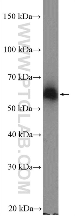 ZNF382 Rabbit anti-Human, Mouse, Polyclonal, Proteintech:Antibodies:Primary