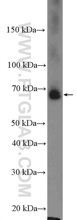 EHHADH Rabbit anti-Human, Polyclonal, Proteintech 150 &mu;L; Unconjugated:Antibodies,