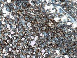 CD55 Rabbit anti-Human, Polyclonal, Proteintech 150 &mu;L; Unconjugated:Antibodies,