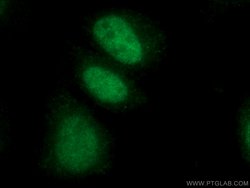 LIG3 Rabbit anti-Human, Mouse, Polyclonal, Proteintech 150 &mu;L; Unconjugated:Antibodies,