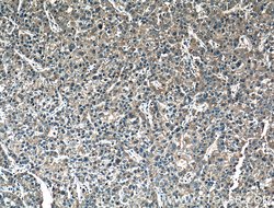MMP1 Rabbit anti-Human, Polyclonal, Proteintech 150 &mu;L; Unconjugated:Antibodies,