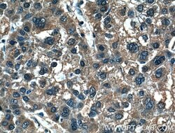 MMP1 Rabbit anti-Human, Polyclonal, Proteintech 150 &mu;L; Unconjugated:Antibodies,