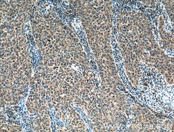 MMP1 Rabbit anti-Human, Polyclonal, Proteintech 150 &mu;L; Unconjugated:Antibodies,