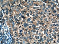 MMP1 Rabbit anti-Human, Polyclonal, Proteintech 150 &mu;L; Unconjugated:Antibodies,
