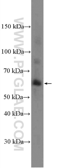 MMP1 Rabbit anti-Human, Polyclonal, Proteintech 150 &mu;L; Unconjugated:Antibodies,