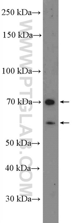 MMP1 Rabbit anti-Human, Polyclonal, Proteintech 150 &mu;L; Unconjugated:Antibodies,