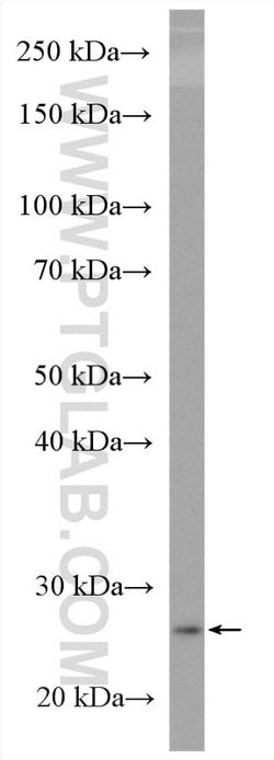 Bcl2 Rabbit anti-Mouse, Polyclonal, Proteintech:Antibodies:Primary Antibodies