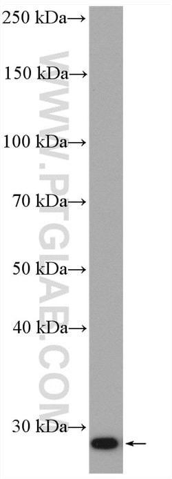 Bcl2 Rabbit anti-Mouse, Polyclonal, Proteintech:Antibodies:Primary Antibodies