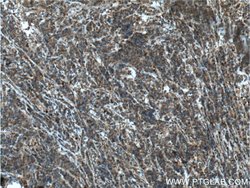 STK17B Rabbit anti-Human, Polyclonal, Proteintech 150 &mu;L; Unconjugated:Antibodies,
