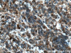 STK17B Rabbit anti-Human, Polyclonal, Proteintech 150 &mu;L; Unconjugated:Antibodies,