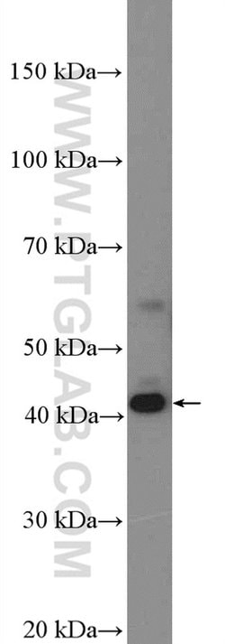 STK17B Rabbit anti-Human, Polyclonal, Proteintech 150 &mu;L; Unconjugated:Antibodies,