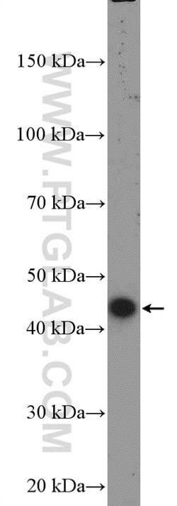 STK17B Rabbit anti-Human, Polyclonal, Proteintech 150 &mu;L; Unconjugated:Antibodies,