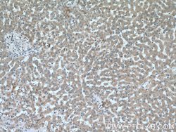SLC40A1 Rabbit anti-Human, Mouse, Polyclonal, Proteintech 150 &mu;L; Unconjugated:Antibodies,
