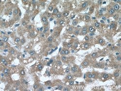 SLC40A1 Rabbit anti-Human, Mouse, Polyclonal, Proteintech 150 &mu;L; Unconjugated:Antibodies,