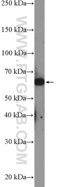 LOXL1 Rabbit anti-Human, Polyclonal, Proteintech:Antibodies:Primary Antibodies