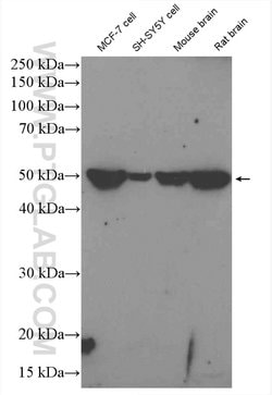 BAG5 Rabbit anti-Human, Mouse, Rat, Polyclonal, Proteintech 20 &mu;L; Unconjugated:Antibodies,