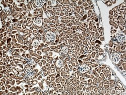 CLRN1 Rabbit anti-Human, Mouse, Polyclonal, Proteintech 150 &mu;L; Unconjugated:Antibodies,