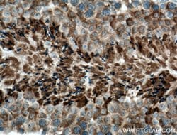 CLRN1 Rabbit anti-Human, Mouse, Polyclonal, Proteintech 150 &mu;L; Unconjugated:Antibodies,