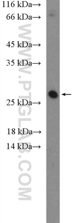 CLRN1 Rabbit anti-Human, Mouse, Polyclonal, Proteintech 150 &mu;L; Unconjugated:Antibodies,