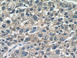 AADAC Rabbit anti-Human, Polyclonal, Proteintech 150 &mu;L; Unconjugated:Antibodies,