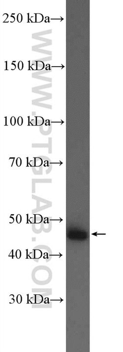 AADAC Rabbit anti-Human, Polyclonal, Proteintech 150 &mu;L; Unconjugated:Antibodies,