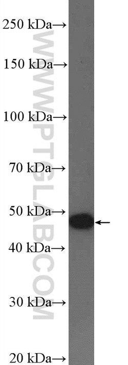 AADAC Rabbit anti-Human, Polyclonal, Proteintech 150 &mu;L; Unconjugated:Antibodies,