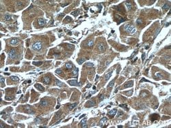 ELAC1 Rabbit anti-Human, Mouse, Polyclonal, Proteintech 150 &mu;L; Unconjugated:Antibodies,
