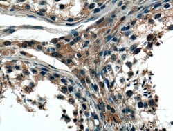 REEP4 Rabbit anti-Human, Mouse, Rat, Polyclonal, Proteintech:Antibodies:Primary