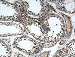 REEP4 Rabbit anti-Human, Mouse, Rat, Polyclonal, Proteintech:Antibodies:Primary