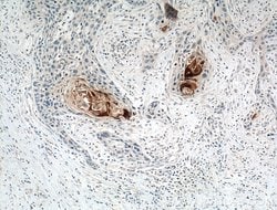S100A7/Psoriasin Rabbit anti-Human, Polyclonal, Proteintech:Antibodies:Primary