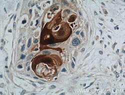 S100A7/Psoriasin Rabbit anti-Human, Polyclonal, Proteintech:Antibodies:Primary