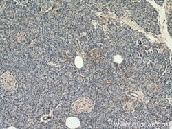SLC25A29 Rabbit anti-Human, Mouse, Rat, Polyclonal, Proteintech:Antibodies:Primary