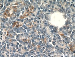 SLC25A29 Rabbit anti-Human, Mouse, Rat, Polyclonal, Proteintech:Antibodies:Primary