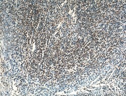 BSAP/PAX5 Rabbit anti-Human, Polyclonal, Proteintech:Anticuerpos:Anticuerpos